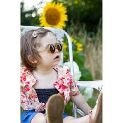  Καλοκαίρι, ήλιος και προφύλαξη των παιδικών ματιών : Όσα πρέπει να ξέρουν οι γονείς!