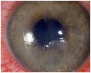 &Upsilon;&pi;&omicron;&tau;&rho;&omicron;&pi;&iota;ά&zeta;&omicron;&upsilon;&sigma;&alpha; &Alpha;&pi;ό&pi;&tau;&omega;&sigma;&eta; &Epsilon;&pi;&iota;&theta;&eta;&lambda;ί&omicron;&upsilon; &Kappa;&epsilon;&rho;&alpha;&tau;&omicron;&epsilon;&iota;&delta;&omicron;ύ&sigmaf;